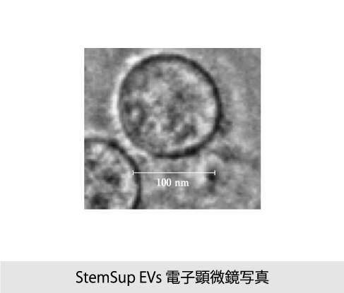 StemSup EVs 電子顕微鏡写真