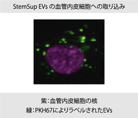 StemSup EVs の血管内皮細胞への取り込み
